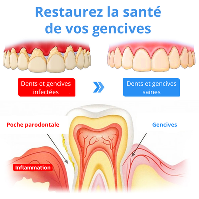Oraluxe - Le 2-en-1 qui protège vos gencives et illumine votre sourire