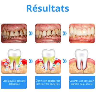 Oraluxe - Le 2-en-1 qui protège vos gencives et illumine votre sourire